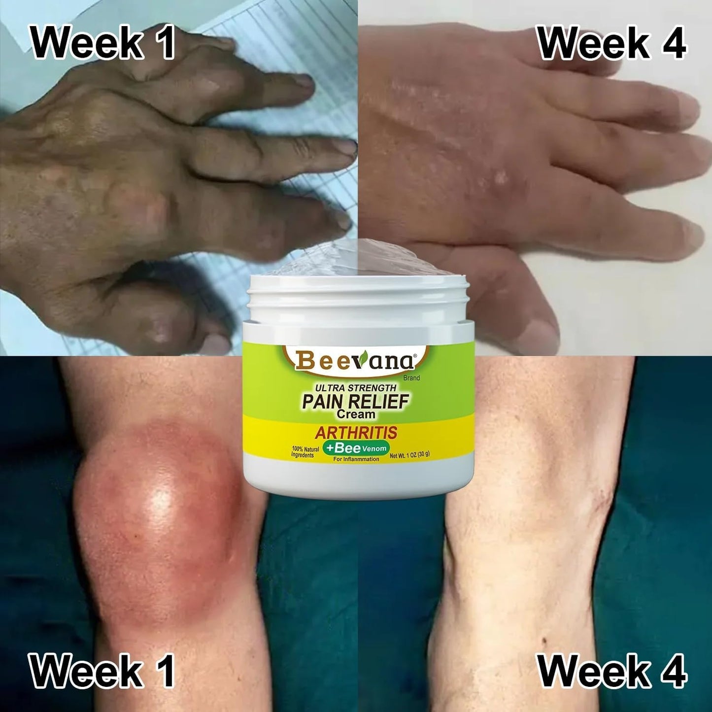 BEEVANA🍃 Restaurador de articulaciones y eliminador de dolor
