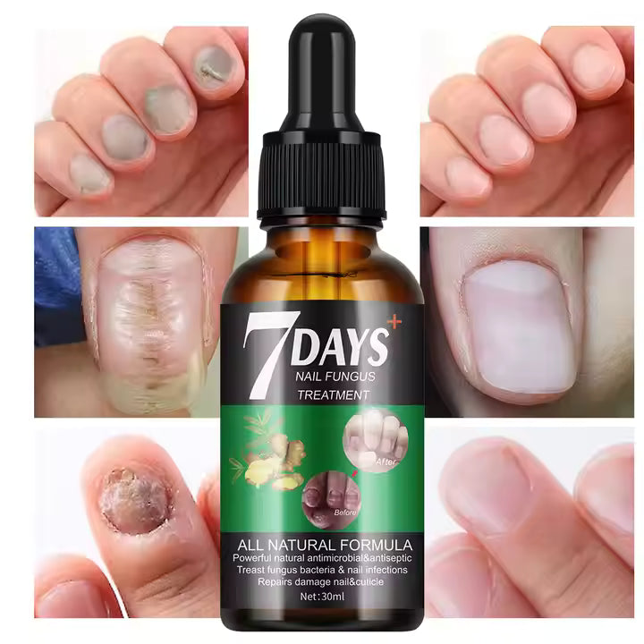 PAGA 1 LLEVA 3 🔥💖 RETO 7 DÍAS LIBRE DE HONGOS EN UÑAS® Protege y elimina el hongo de tus uñas