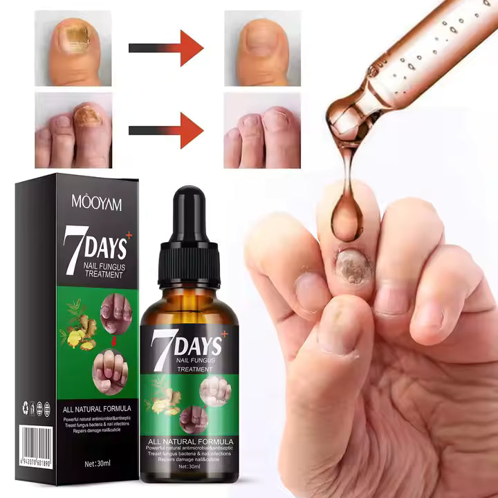 PAGA 1 LLEVA 3 🔥💖 RETO 7 DÍAS LIBRE DE HONGOS EN UÑAS® Protege y elimina el hongo de tus uñas