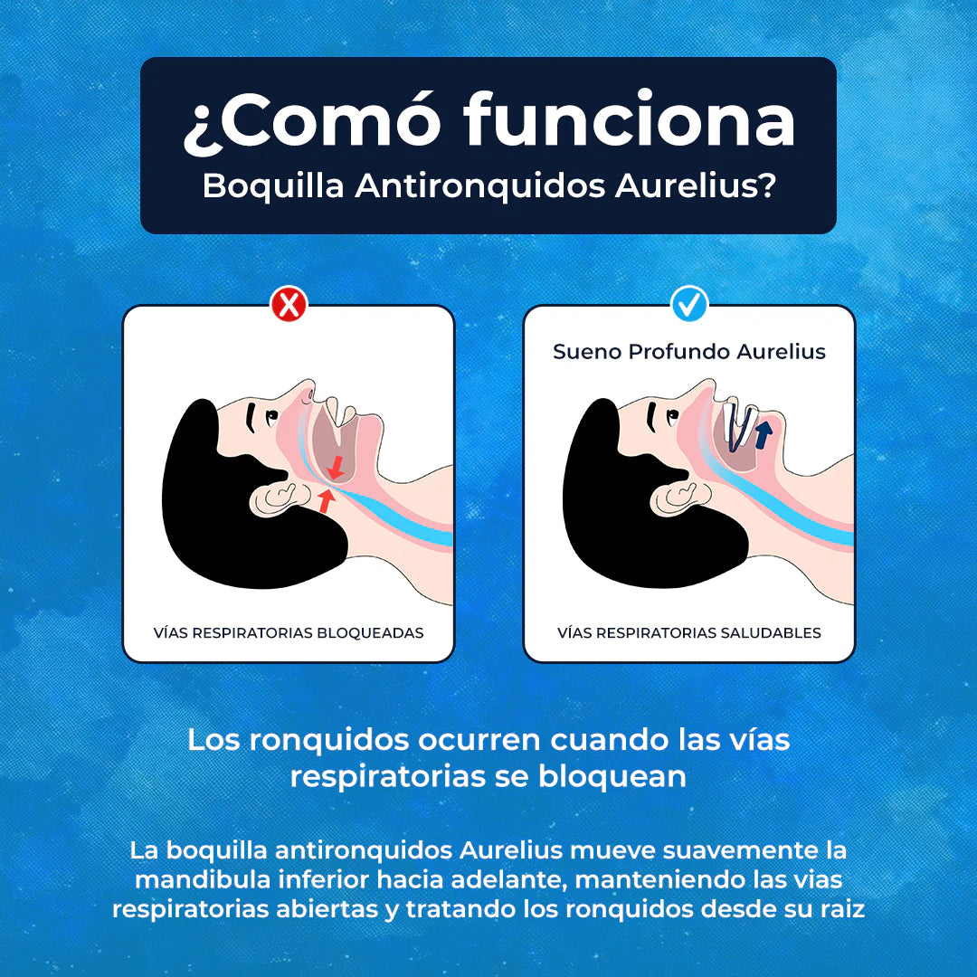 SLEEP CALM® Moldura antirrontidos correctora de bruxismo🦷