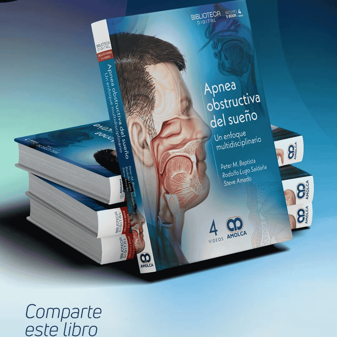 Apnea Obstructiva del Sueño - Un enfoque multidisciplinario