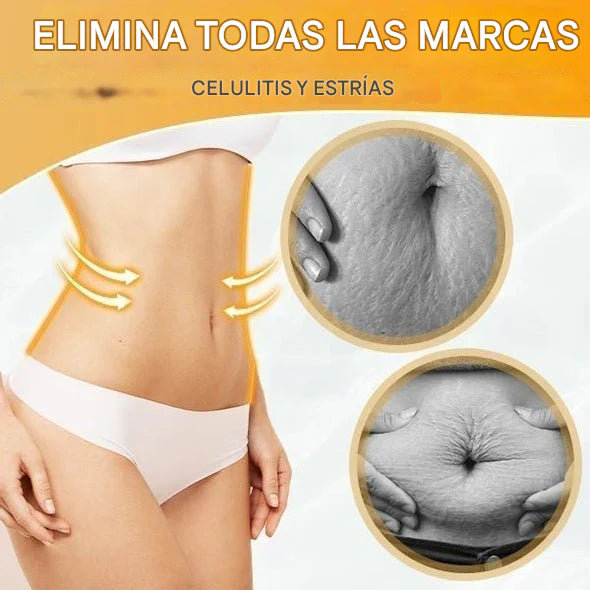 Aceite quemador de grasa + Reafirmante + Drenaje linfático | PAGA 1 LLEVA 2 PROMO