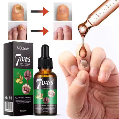 PAGA 1 LLEVA 3 🔥💖 RETO 7 DÍAS LIBRE DE HONGOS EN UÑAS® Protege y elimina el hongo de tus uñas