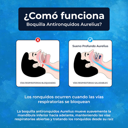 SLEEP CALM® Moldura antirrontidos correctora de bruxismo🦷