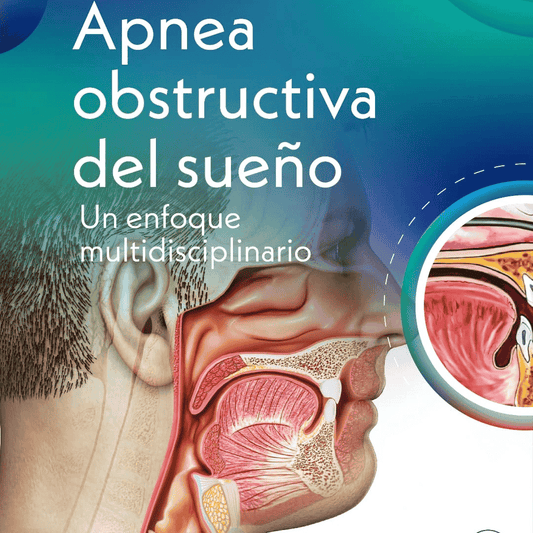 Apnea Obstructiva del Sueño - Un enfoque multidisciplinario