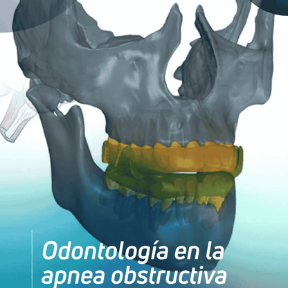 Apnea Obstructiva del Sueño - Un enfoque multidisciplinario