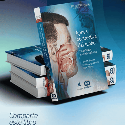 Apnea Obstructiva del Sueño - Un enfoque multidisciplinario