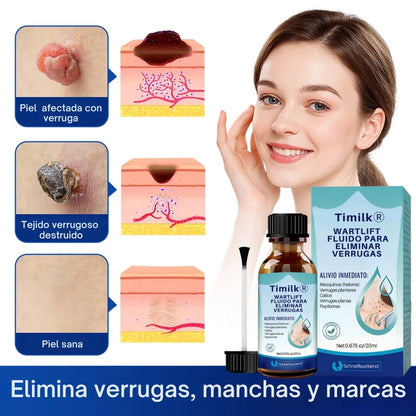Timilk® WartLift Fluido para eliminar verrugas ✨