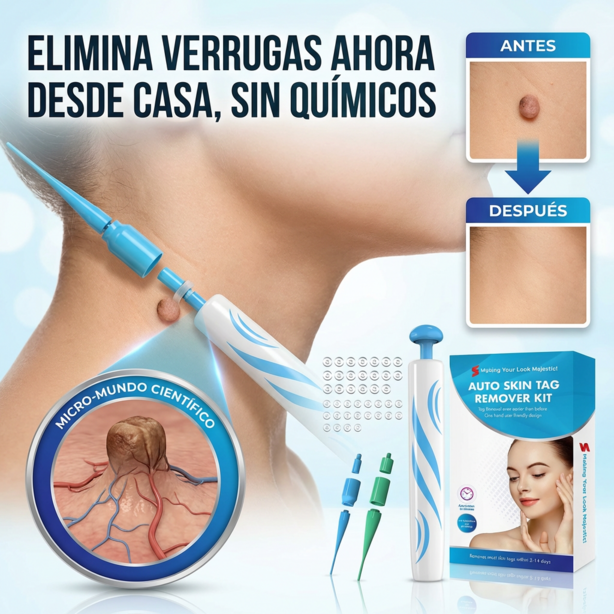 LigueWart® Terapia de eliminación a presión de verrugas 🛡️✂️ desprendimiento en 10 días