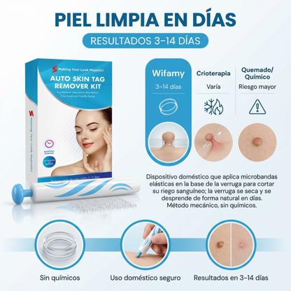 LigueWart® Terapia de eliminación a presión de verrugas 🛡️✂️ desprendimiento en 10 días