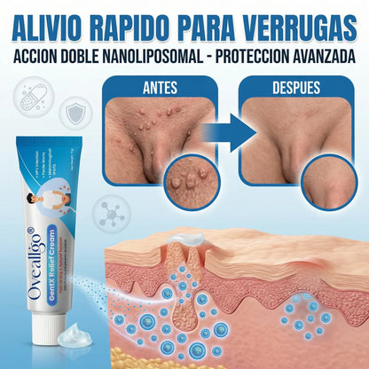 PlusWart® Oveallgo GentX 🍃 Ritual magistral para el tratamiento y remoción de verrugas íntimas