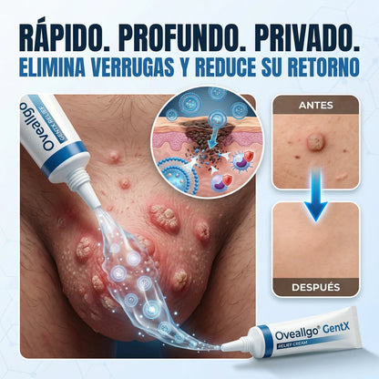 PlusWart® Oveallgo GentX 🍃 Ritual magistral para el tratamiento y remoción de verrugas íntimas