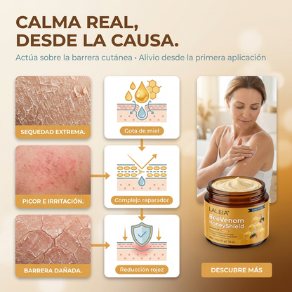 Crema para el tratamiento de la psoriasis Laleia® con veneno de abeja