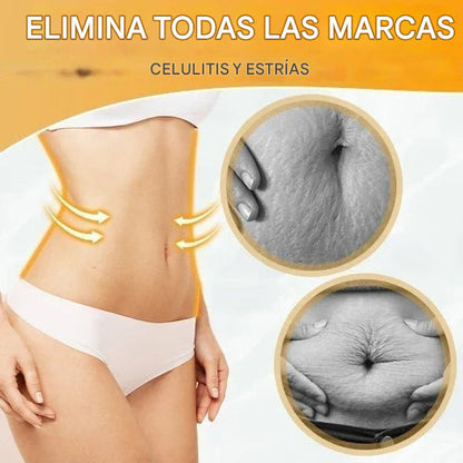 Aceite quemador de grasa + Reafirmante + Drenaje linfático | PAGA 1 LLEVA 2 PROMO