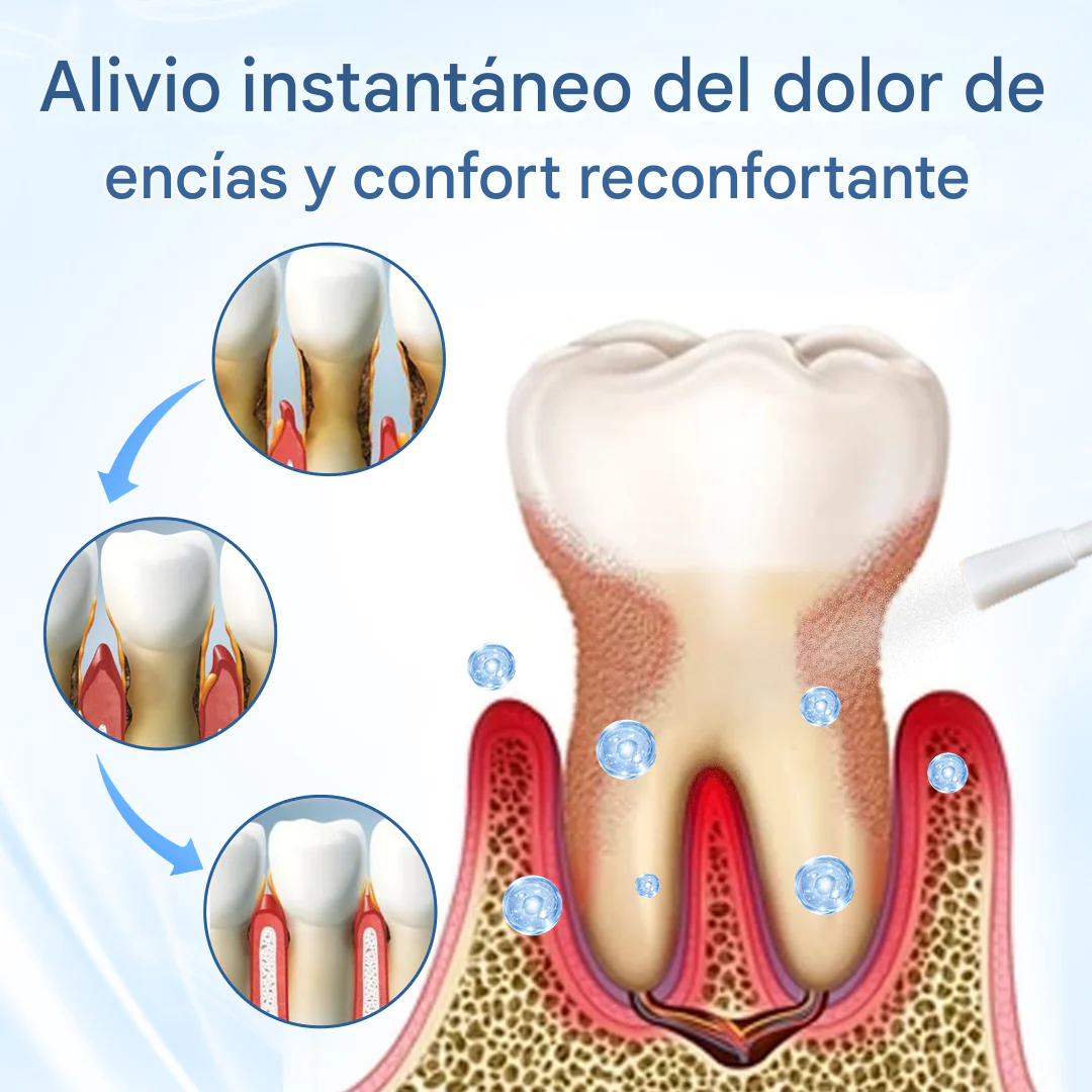 ENTIX CARE® Rehabilitador bucal para encías🦷✨ barrera antisensibilidad, antiinflamatorio y antiseptico bucal