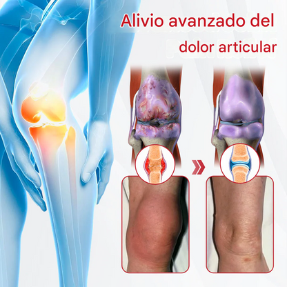 HorseEase Timilk® Crema para el alivio de las articulaciones 🐎