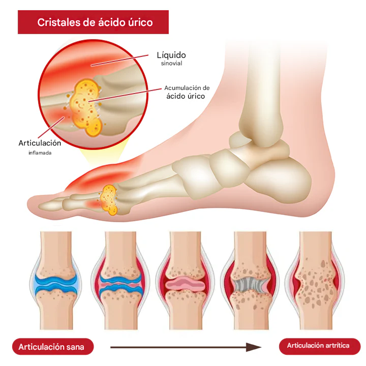 HorseEase Timilk® Crema para el alivio de las articulaciones 🐎