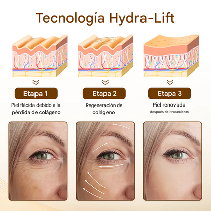 Suero antiarrugas Biancat® Liftora 10s