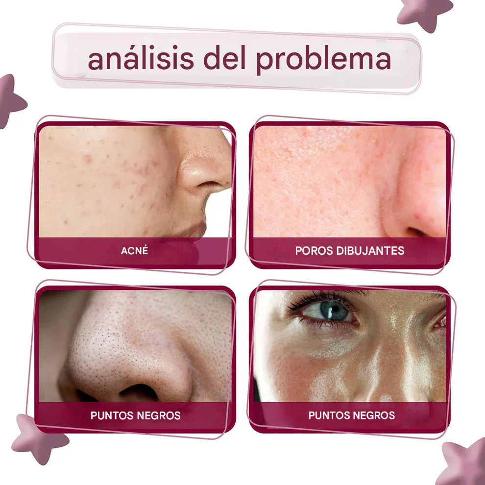 JAYSUING® Serum ANTIACNÉ coreano con Centella Asiática