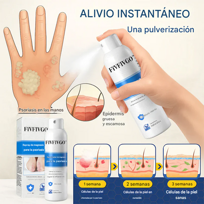 REGEM® Spray herbal de magnesio para la psoriasis