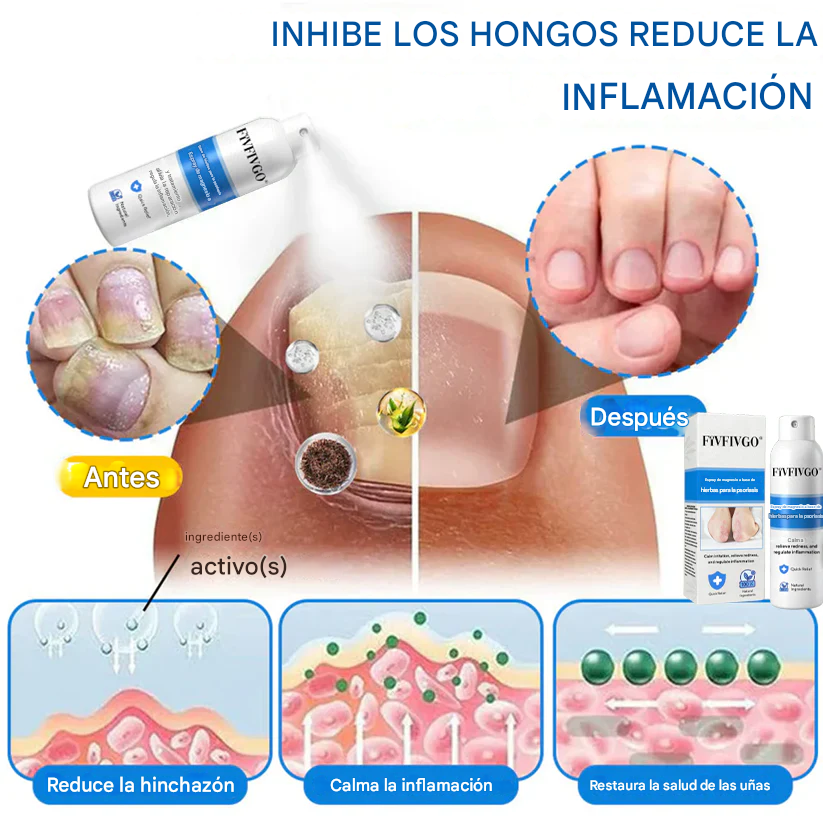 REGEM® Spray herbal de magnesio para la psoriasis