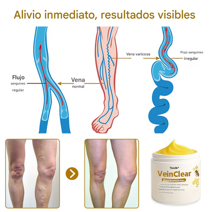 Crema de veneno de abeja Timilk® VeinClear | ✨ ¡Alivio visible en solo 7 días! 🦵🌿