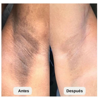 🏵️ACEITE TRULY✨Una piel radiante, sin manchas y con un aroma irresistible todos los días!🏵️